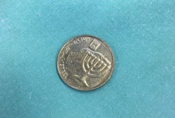 המטבע שנשלף מגרונו של הילד (קרדיט צילום: המרכז הרפואי זיו)