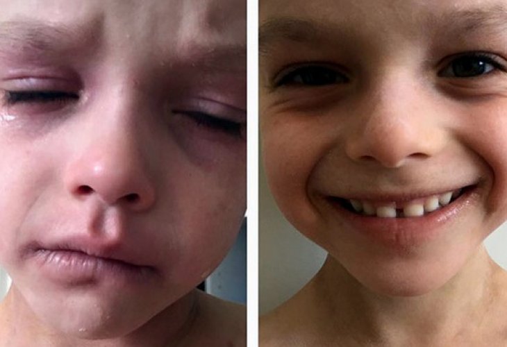 Tyler before and after the cream treatment (Screenshot)