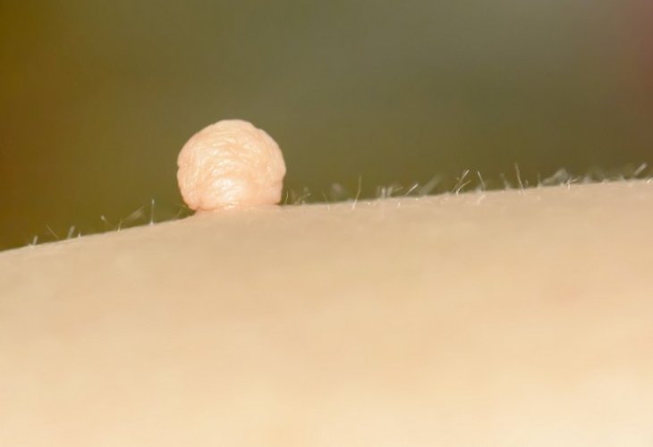 (Photo: shutterstock)