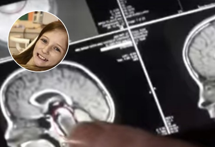 Roxli Doss against the background of the scan that amazed doctors (Screenshot) Roxli Doss against the background of the scan that amazed doctors (Screenshot)
