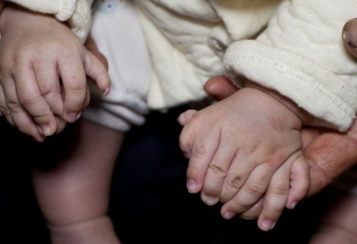 Image of Hong Hong, the Chinese child born with 31 fingers and toes. Image of Hong Hong, the Chinese child born with 31 fingers and toes.