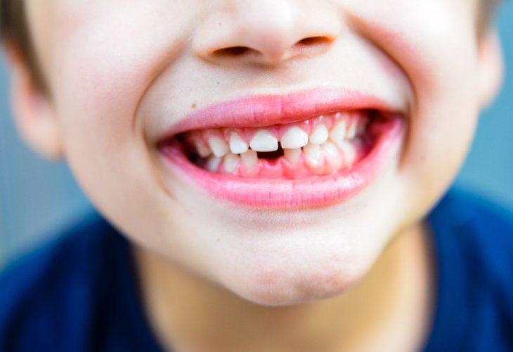 (Photo: shutterstock) (Photo: shutterstock)