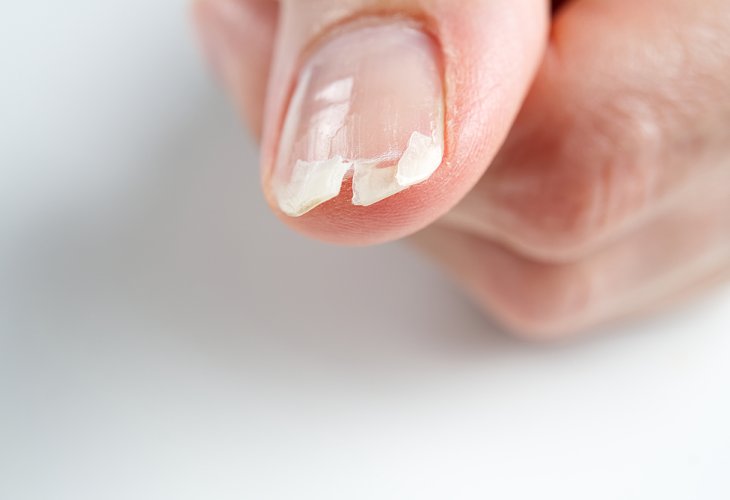 (Photo: shutterstock)