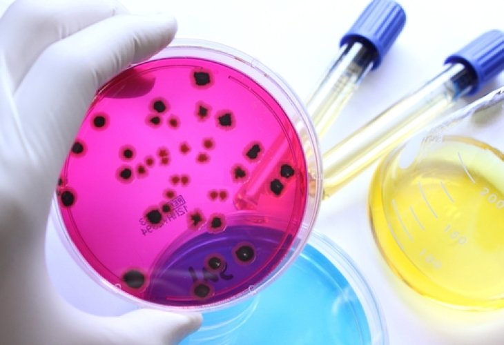 Bacteria in laboratory dishes (Photo: shutterstock) Bacteria in laboratory dishes (Photo: shutterstock)