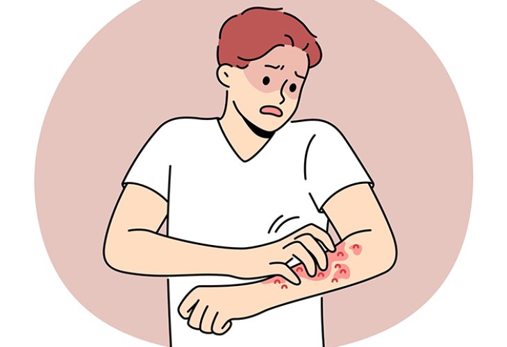 (Illustration: shutterstock)