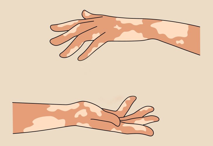 Illustration: shutterstock