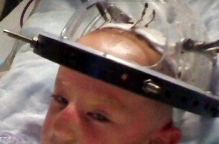 ג’ארלד בבית החולים, לאחר שעבר את הניתוחים בראשו (צילום מסך)