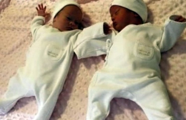 התאומות אביגיל ואיזבל בעת לידתן (צילום: מתוך יוטיוב)