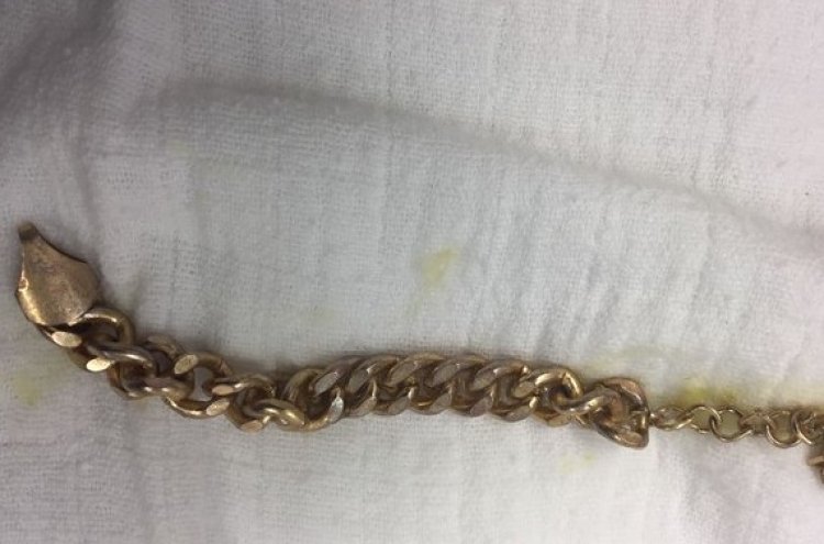 השרשרת שנשלפה מקיבת הפעוט (צילום: דוברות בית חולים רמב"ם)
