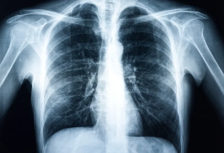 (קרדיט: shutterstock)