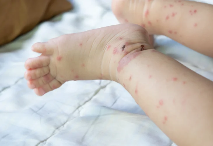 (קרדיט: shutterstock)