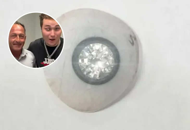 בעיגול: סלייטר ג'ונס עם מומחה התותבות שיצר את העין היקרה ביותר בעולם (צילום מסך)