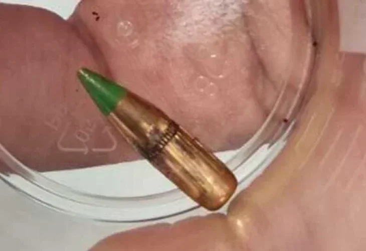 הכדור התועה (צילום: דוברות המשטרה)