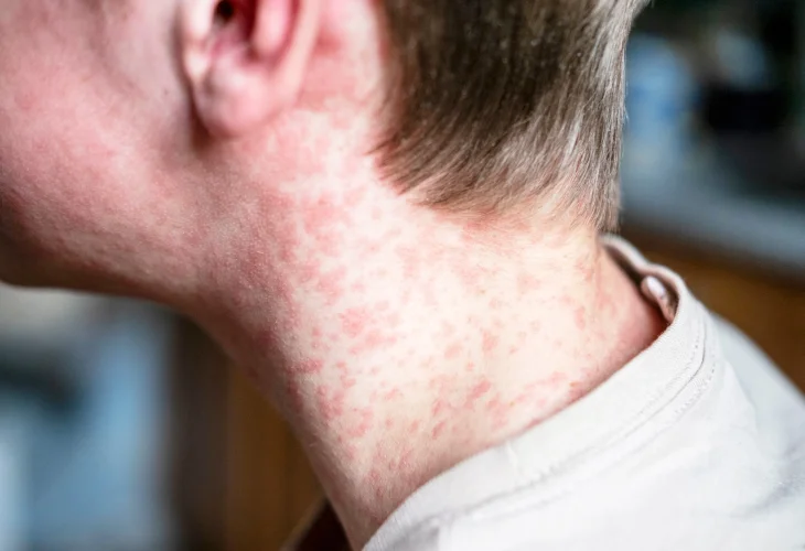 (קרדיט: shutterstock)