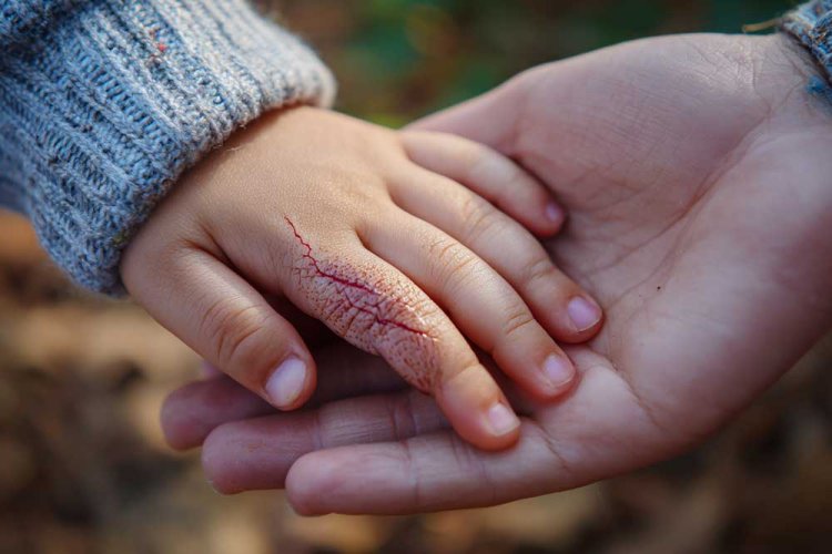 ילד שנפצע ונראה שהפצע מדמם באופן חריג